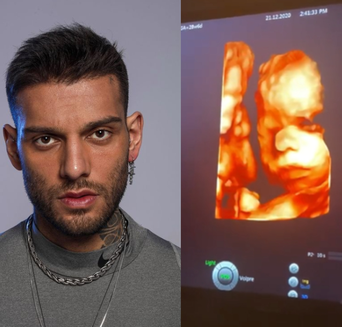 Lucas Lucco compartilha ultrassom do filho e diz: <I>Bocão!</i>