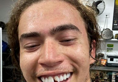 Whindersson Nunes quebra dente em treino de luta e faz piada com seguidores