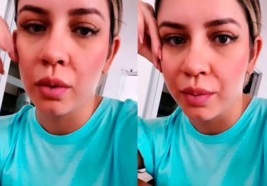 Marília Mendonça explica sumiço das redes sociais: <i>- Descobri uma alergia a camarão</i>
