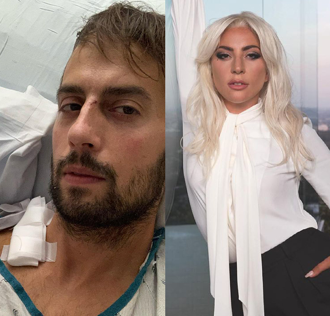 Funcionário de Lady Gaga que foi baleado durante roubo dos cães da cantora fala sobre recuperação: <i>Meu pulmão entrou em colapso</i>