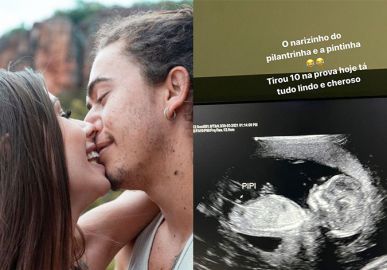 Whindersson Nunes compartilha ultrassom do filho e elogia a noiva: <I>Tá tão gatinha grávida</I>
