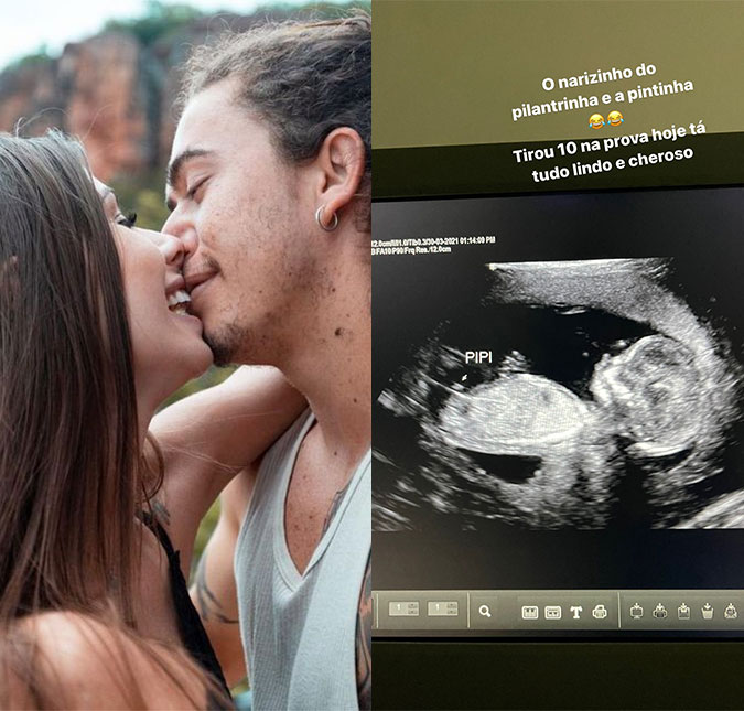 Whindersson Nunes compartilha ultrassom do filho e elogia a noiva: <I>Tá tão gatinha grávida</I>