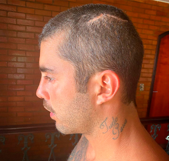 Pedro Scooby publica fotos de cicatriz na cabeça e alerta: <i>Se não tem estômago, não passa pro lado</i>