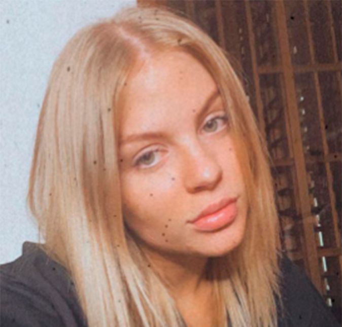 Ela afirma que só fez preenchimento labial e nunca aplicou Botox: Falam como se eu fosse doente, como se eu tivesse um distúrbio de imagem, sendo que vocês me conheceram quando eu tinha 16 anos e eu já tenho 22. É óbvio que meu rosto mudou e minha maquiagem mudou. E a forma como eu faço a maquiagem muda o rosto. Eu não tenho porque mentir, não sou contra isso. Um dia quando precisar colocar Botox, eu vou colocar. [...] Eu só coloquei boca, nem Botox eu coloquei ainda., disse ela. No clique acima, divulgado em agosto de 2020, a cantora já aparece com preenchimento labial. No desabafo, ela afirmou que se acha perfeita: Eu só não fiz cirurgia plástica porque eu realmente me acho muito perfeita. Me acho tão linda. Não se preocupem. Sou insuportável. Acho perfeito meu nariz, amo tudo em mim. Minha autoestima é tão alta, mesmo as pessoas falando que eu sou horrível todos os dias..