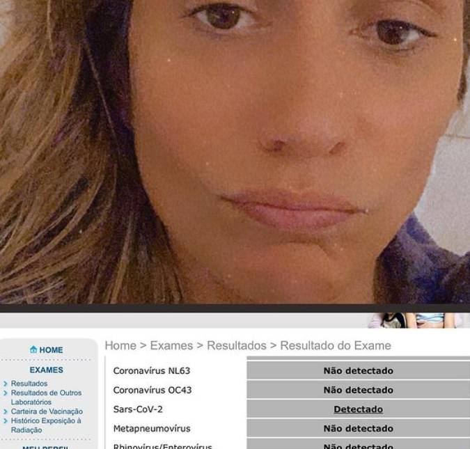 Luisa Mell é diagnosticada com coronavírus pela segunda vez: <i>Rezem por mim, tá difícil</i>