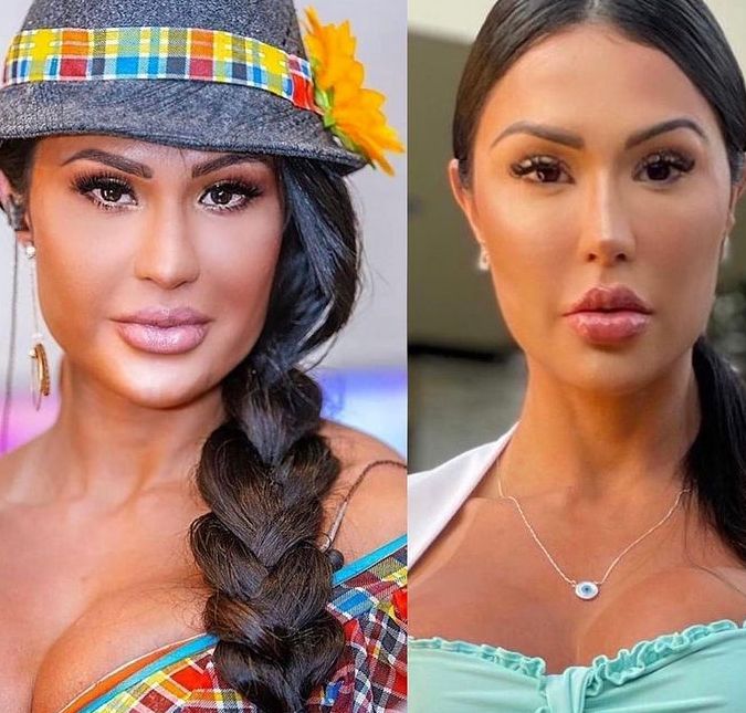 A influenciadora comentou que não gostava de suas bochechas mais cheias