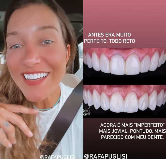 Gabriela Pugliesi troca lentes dos dentes e diz que queria um resultado mais natural: <i>Agora é mais imperfeito</i>