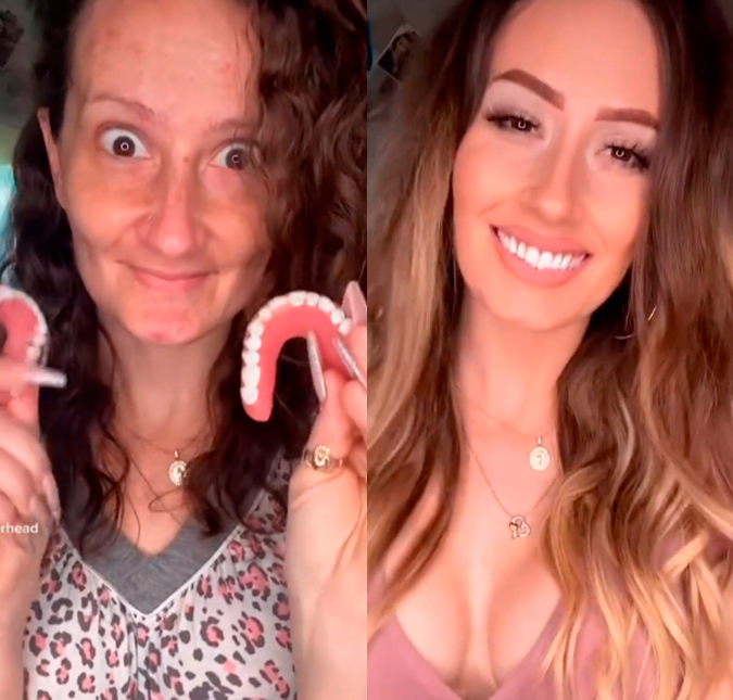 Influenciadora que perdeu os dentes durante gestação surpreende com transformações; confira!