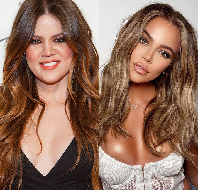 Khloé Kardashian finalmente admite ter feito rinoplastia: <I>- Ninguém nunca me perguntou antes</I>