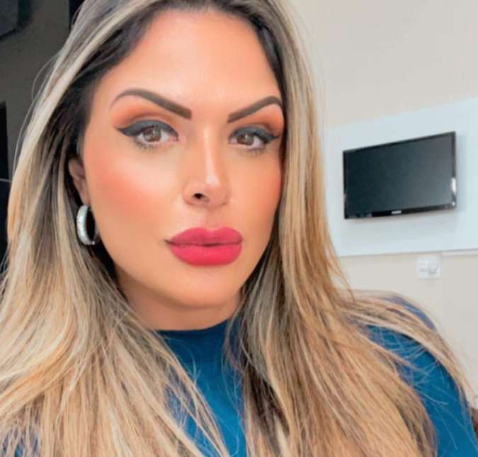 Após sofrer agressão do ex-namorado, Silvye Alves volta a trabalhar