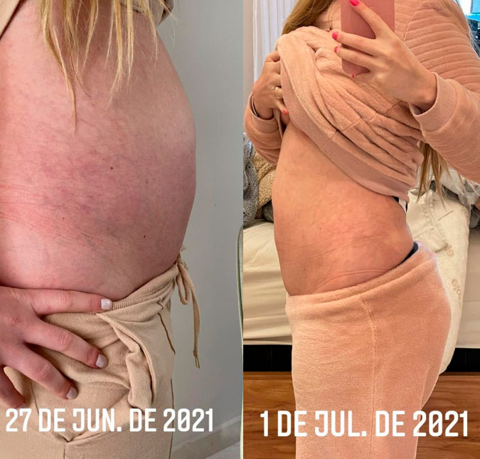 Bárbara Evans compartilha evolução da barriga em tratamento de fertilização