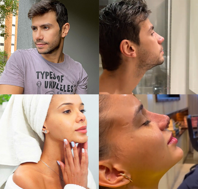 Jakelyne Oliveira e Mariano exibem resultado de rinoplastia: <I>Muito feliz com o resultado</I>