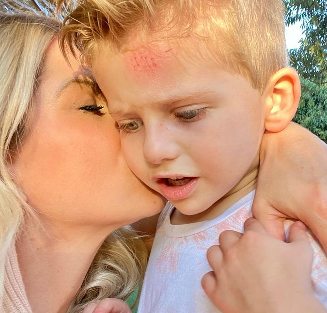 Karina Bacchi mostra a testa do filho machucada nas redes sociais