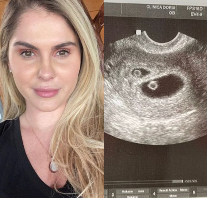 Monique Evans compartilha ultrassom da filha, Bárbara: <i> - Sou a vovó mais feliz do mundo</i>