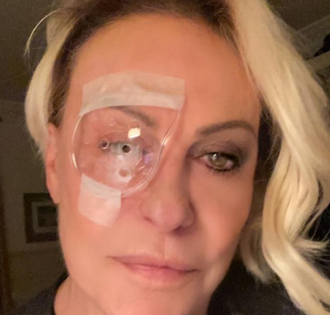 Ana Maria Braga posa com tampão no olho e fala sobre cirurgia
