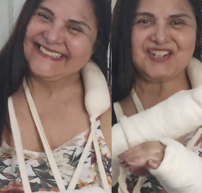 Atriz Elizângela leva tombo em casa e fratura os dois braços