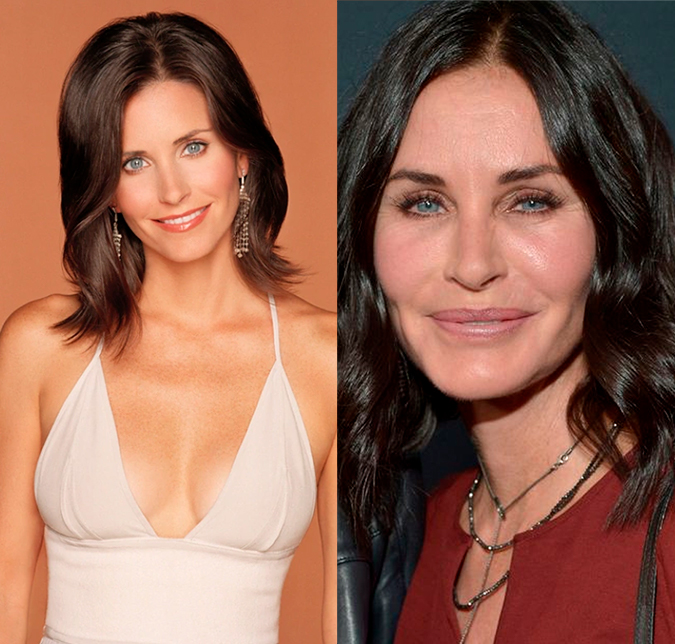 Courteney Cox, estrela de <I>Friends</i>, admite que ficou <I>estranha</i> após procedimentos estéticos exagerados