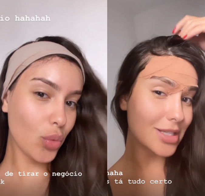 Thaís Braz mostra resultado de sua testa após cirurgia