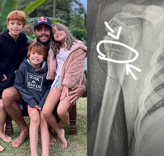 Luana Piovani revela que filho fraturou o ombro: <I>Corre para o hospital</i>