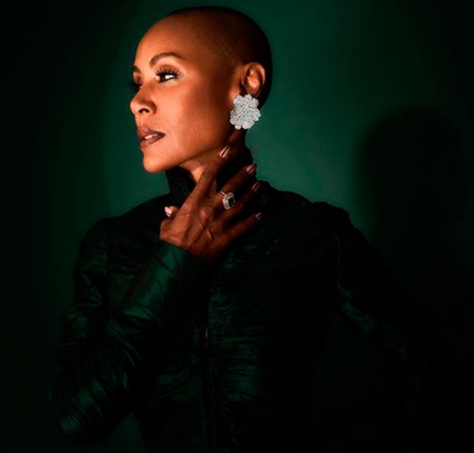 Jada Pinkett Smith teve sua condição autoimune de calvície feminina precoce ironizada por Chris Rock na 94° edição do Oscar 2022. Anteriormente, a atriz já havia explicado o motivo da cabeça raspada nas redes sociais e revelou ter alopecia provocada por fatores genéticos, resultando na queda de cabelo. Cheguei ao ponto em que só posso rir. Vocês sabem que eu tenho lidado com a alopecia e, do nada, aparece essa falha aqui. Olhem só. Ela veio do nada e vai ser mais difícil de esconder. Então achei melhor mostrar para todos para não surgirem dúvidas. Jada Pinkett Smith teve sua condição autoimune de calvície feminina precoce ironizada por Chris Rock na 94° edição do Oscar 2022. Anteriormente, a atriz já havia explicado o motivo da cabeça raspada nas redes sociais e revelou ter alopecia provocada por fatores genéticos, resultando na queda de cabelo. Cheguei ao ponto em que só posso rir. Vocês sabem que eu tenho lidado com a alopecia e, do nada, aparece essa falha aqui. Olhem só. Ela veio do nada e vai ser mais difícil de esconder. Então achei melhor mostrar para todos para não surgirem dúvidas.