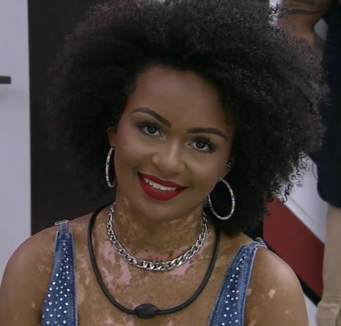 Internautas atacam Natália do <I>BBB22</i> por conta de vitiligo