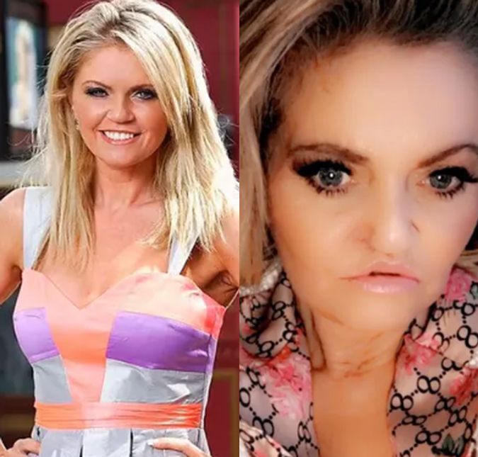 Danniella Westbrook, que precisou passar por diversas cirurgias nos últimos anos para reconstruir a face, foi pedida em casamento durante visita na cadeia para o detento David