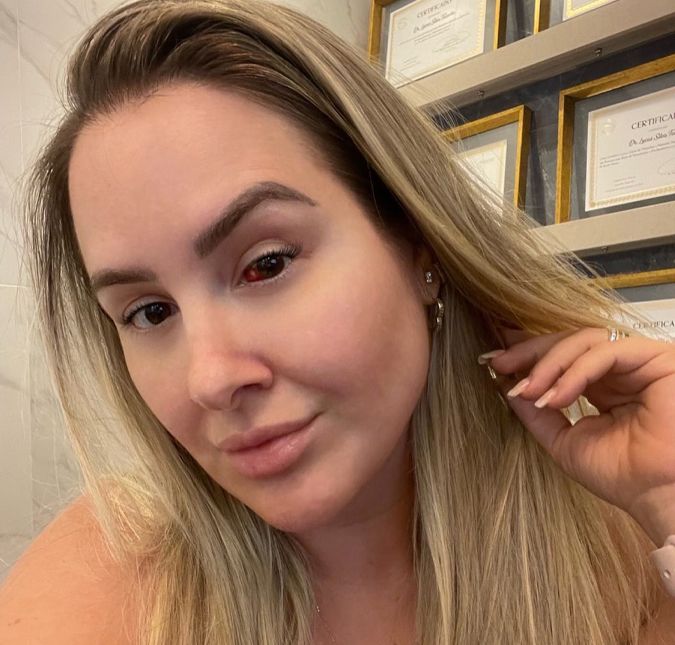 Nas redes sociais, ela contou detalhes do derrame