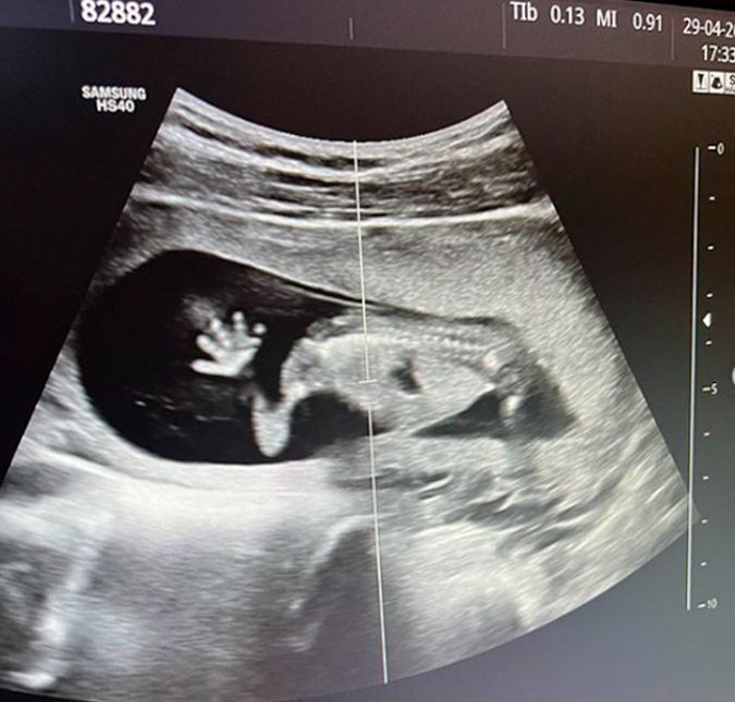 Com 14 semanas, ela mostrou que o bebê já estava bem diferente da primeira ultrassonografia. Já te amo muito, meu amor, que Deus te abençoe e que você venha com muita saúde. A mãozinha e o pezinho para vocês verem, pessoal. Todo babão, Zé Felipe comentou na publicação:  O papai ama vocês demais. Poliana Rocha, sogra de Virginia, também se pronunciou: Vovó já ama.