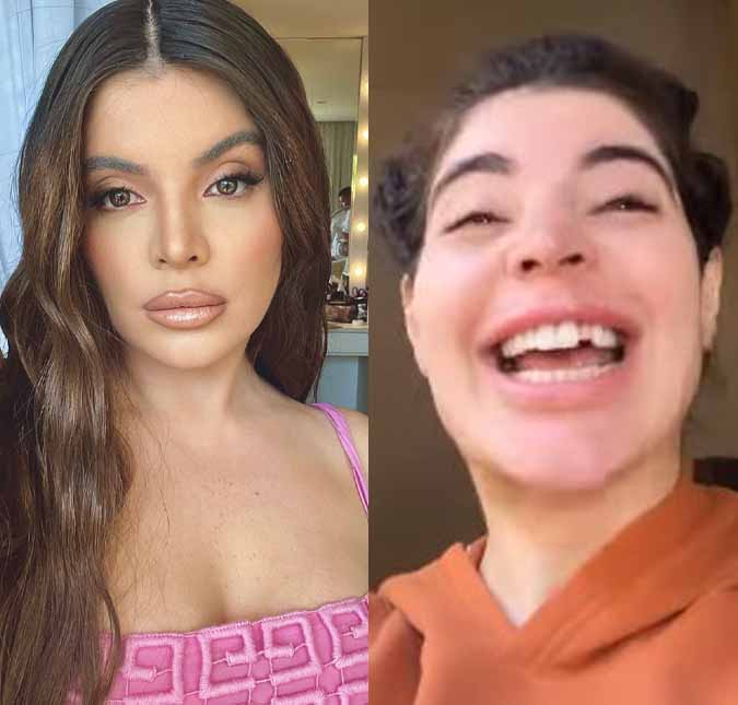 Gkay quebra lente dental durante a noite e surge banguela: <i>Tenho um bruxismo fortíssimo</i>