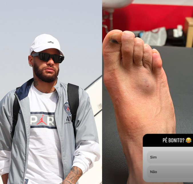 Após se machucar em treino, Neymar Jr. mostra o pé lesionado e brinca: <i>Bonito?</i>