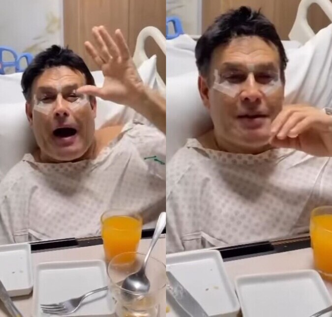 Sérgio Mallandro faz cirurgia nas pálpebras e explica: <i>Meu olho ficava muito fechado</i>