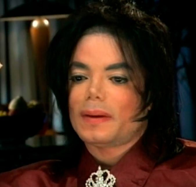Ainda que a vida das celebridades esteja cercada de fama, dinheiro e prestígio, às vezes elas também passam por maus bocados. Michael Jackson, o Rei do Pop, teve muitos problemas na infância com o pai e sofreu uma série de acusações graves sobre pedofilia. Mas o cantor também sofreu muito quando foi fazer um comercial da Pepsi, em 1984. O cabelo de Michael pegou fogo após a produção ter liberado os efeitos pirotécnicos antes da hora. Ele sofreu queimaduras de segundo e terceiro grau, passou por cirurgias e ficou muito fragilizado emocionalmente com o acontecido, tendo que usar peruca. Inclusive, de acordo com mídia internacional, foi aí que começou o vício em analgésicos e drogas mais fortes, por conta da excruciante dor que sentia. A seguir, confira mais famosos que superaram acidentes graves. Ainda que a vida das celebridades esteja cercada de fama, dinheiro e prestígio, às vezes elas também passam por maus bocados. Michael Jackson, o Rei do Pop, teve muitos problemas na infância com o pai e sofreu uma série de acusações graves sobre pedofilia. Mas o cantor também sofreu muito quando foi fazer um comercial da Pepsi, em 1984. O cabelo de Michael pegou fogo após a produção ter liberado os efeitos pirotécnicos antes da hora. Ele sofreu queimaduras de segundo e terceiro grau, passou por cirurgias e ficou muito fragilizado emocionalmente com o acontecido, tendo que usar peruca. Inclusive, de acordo com mídia internacional, foi aí que começou o vício em analgésicos e drogas mais fortes, por conta da excruciante dor que sentia. A seguir, confira mais famosos que superaram acidentes graves.