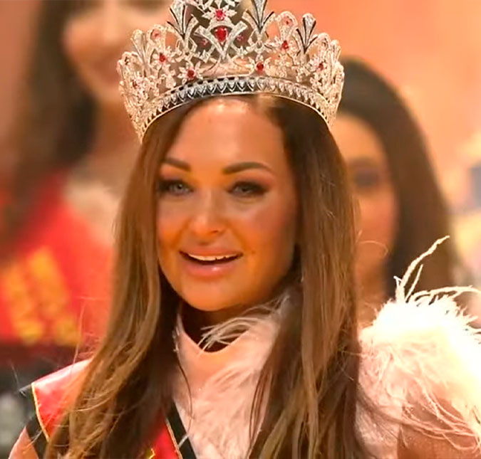 Miss Bélgica 2022 exibe cliques no hospital após sofrer grave acidente de carro: <I>A saúde mental é importante</i>