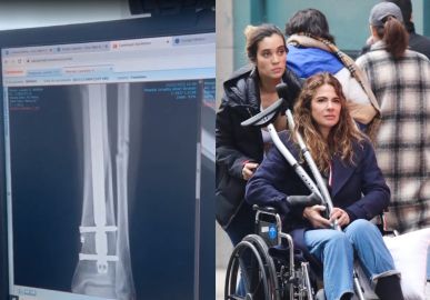Luciana Gimenez mostra evolução do osso quebrado após passar por cirurgia. Saiba tudo sobre o acidente na neve da apresentadora