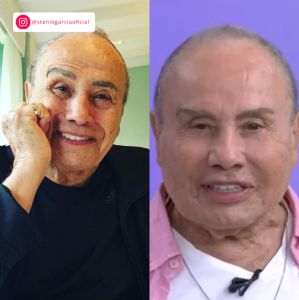 IInfluencer Bruno Diferente faz harmonização facial; veja resultado