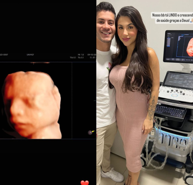 Arthur Aguiar acompanha Jheny Santucci em ultrassom e se derrete ao ver bebê. Veja tudo o que sabemos da gravidez do ex-casal