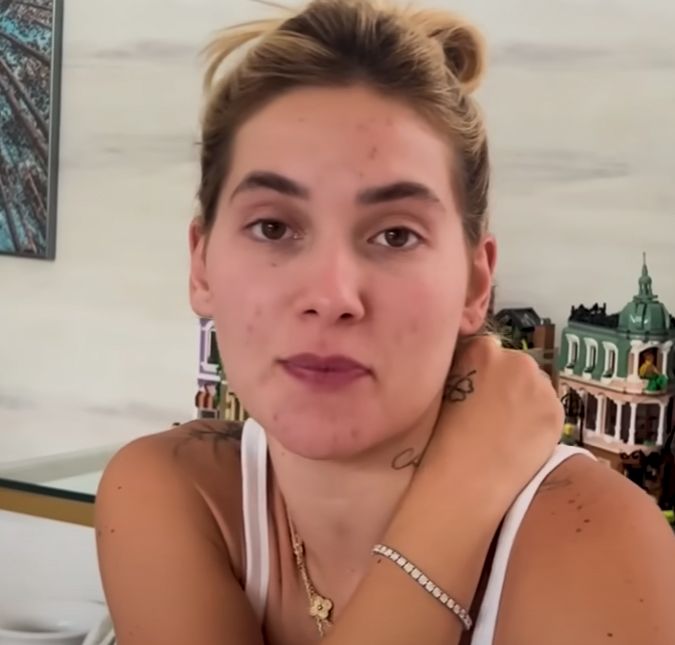 Virginia Fonseca mostra rosto empolado após forte alergia: Estou toda coçando A influenciadora postou uma foto em suas redes sociais