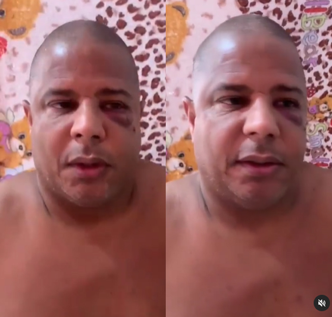 Marcelinho Carioca aparece machucado em vídeo falando sobre envolvimento com mulher casada; polícia acredita na veracidade das imagens
