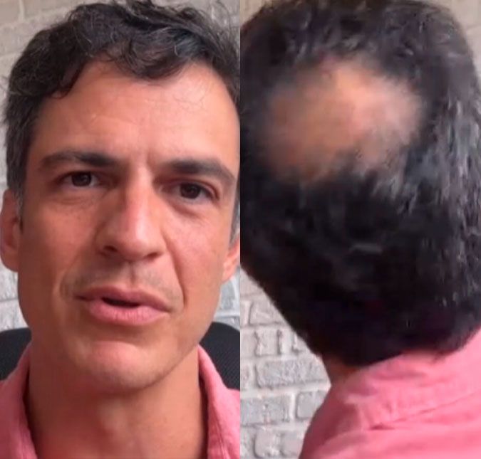 Mateus Solano assume careca e conta que não tem planos de fazer implante: - Choveu proposta O ator fez uma reflexão sobre o que é ser galã