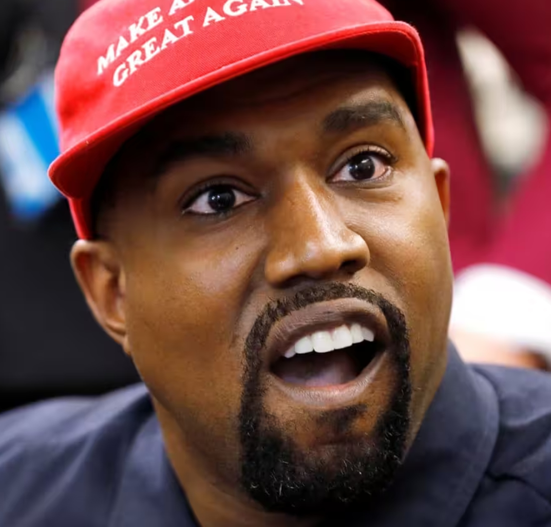Kanye West remove dentes e substitui por prótese de titânio de quatro milhões de reais; veja