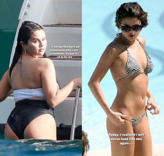 Selena Gomez faz antes e depois de seu corpo: <I>Não sou perfeita, mas tenho orgulho de ser quem sou</i>