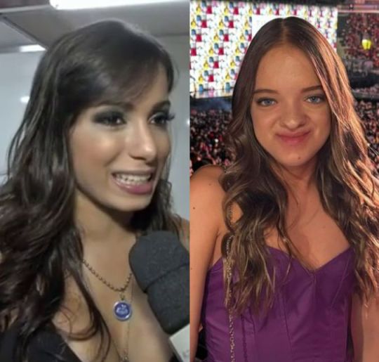 Rafa Justus, Fernanda Souza, Anitta e outras celebridades que fizeram cirurgias plásticas antes dos 21 anos de idade