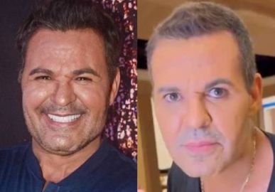 Internautas comentam aparência de Eduardo Costa: <i>Secou mesmo!</i>