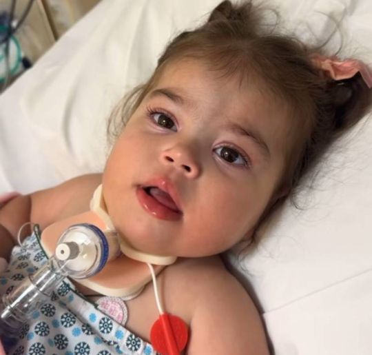Juliano Cazarré atualiza estado da filha após procedimento para trocar cânula. Veja tudo sobre o caso da criança