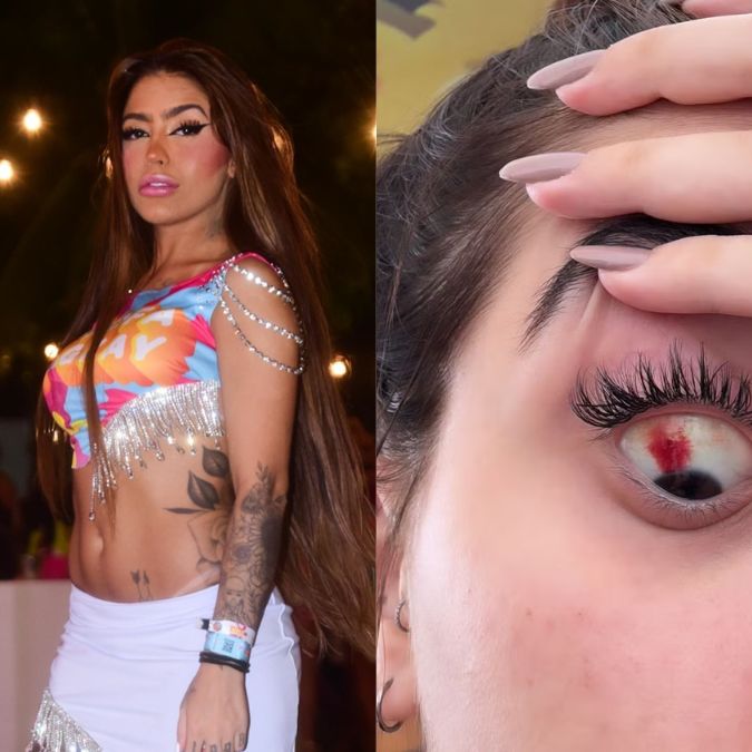 MC Mirella se assusta ao notar derrame ocular após gravar vídeo