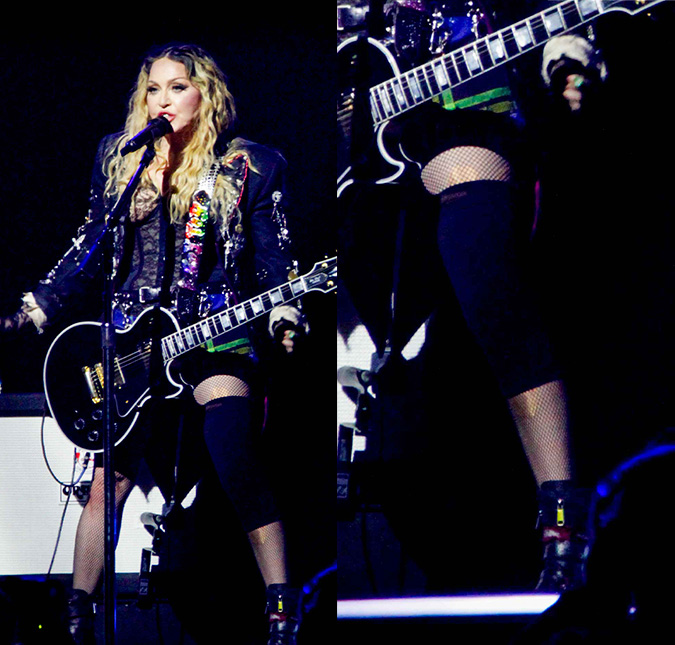 Descubra o motivo de Madonna ter usado joelheira no <I>show</i> do Rio de Janeiro