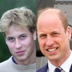 Aos 41 anos de idade, veja a evolução de Príncipe William!
