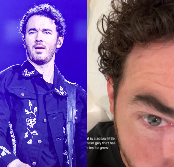 Kevin Jonas passa por procedimento para remover câncer de pele do rosto