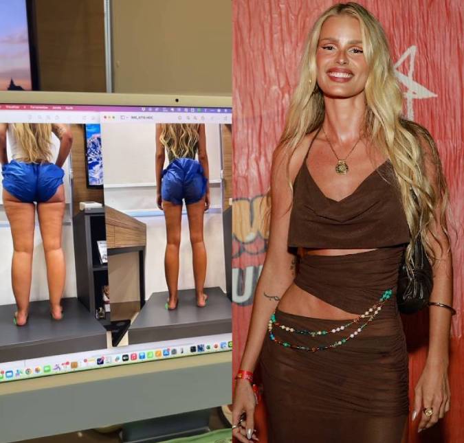 Yasmin Brunet comemora resultado de tratamento nas pernas: <i>Isso é surreal</i>