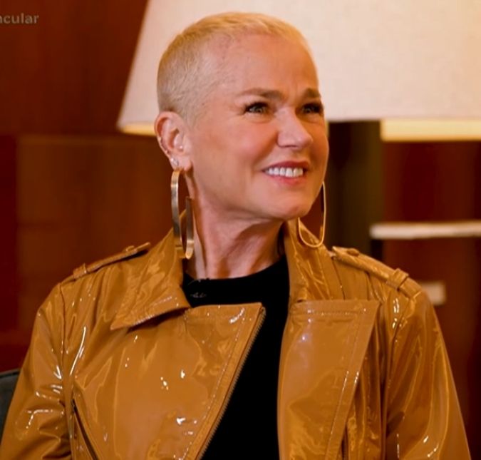 Xuxa Meneghel fala sobre alopecia androgenética e revela o que a motivou a fazer o transplante capilar